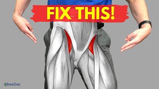 How to Relieve Hip Flexor Pain in 30 SECONDS [upl. by Erhart]