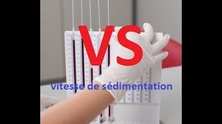 Vitesse de sédimentation VS [upl. by Georg767]