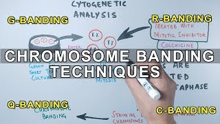 Chromosome Banding Techniques [upl. by Aicnerolf985]