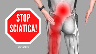 How to Relieve Sciatica Pain in SECONDS [upl. by Hteboj]