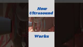 How Ultrasound Works  Ultrasonic Waves [upl. by Ahsinehs]