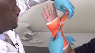 Everything You Need to Know About Casts and Cast Care [upl. by Hadeis]