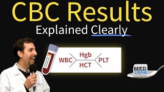 Graves Disease  Overview causes pathophysiology investigations and treatment [upl. by Ralph]