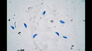 Toxoplasma gondii  live trophozoites [upl. by Notsag]