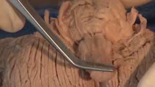 Cranial Nerves Neuroanatomy Video Lab  Brain Dissections [upl. by Asylla]