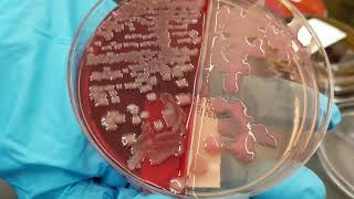 Microbiology Normal versus Pathogenic Bacteria in Urine Wound and Bite Cultures [upl. by Ollecram1]