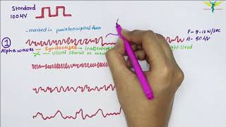 Electroencephalogram EEG  Waves  Physiology [upl. by Siahc]