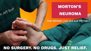 Morton’s Neuroma The NonSurgical Treatment [upl. by Nylatsirk]