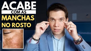 Acabe com as MANCHAS NA PELE inclusive MELASMA  Receita Caseira [upl. by Arimaj]