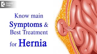 What is Hernia Symptoms Causes Types Treatment  Dr Harish N S  Doctors Circle [upl. by Ernie]