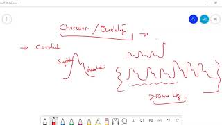 Types of PulsePulsus Paradoxus Pulsus Alternans Anacrotic Waterhammer pulse [upl. by Annaierb]