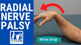 Radial Nerve Palsy Wrist Drop Evaluation [upl. by Lengel424]