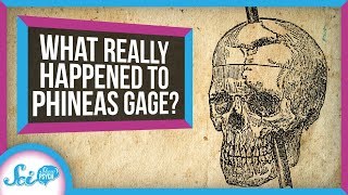 What Really Happened to Phineas Gage [upl. by Violante]