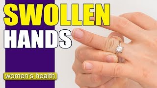 What Causes Swollen Hands  Reduce Swelling [upl. by Caril]