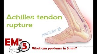 Achilles Tendon Rupture [upl. by Stamata]