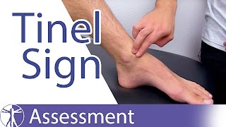 Tinels Sign Ankle⎟Peripheral Nerve Injury [upl. by Haisej173]