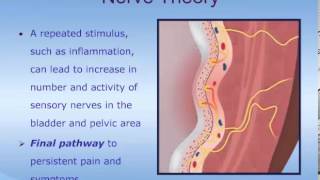 Understanding Interstitial Cystitis ICPainful Bladder Syndrome PBS [upl. by Einhoj722]