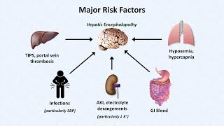 Hepatic Encephalopathy [upl. by Htiaf]