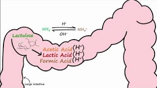 An Overview of Infectious Encephalitis [upl. by Haidadej]