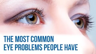 Common eye problems [upl. by Dayle]