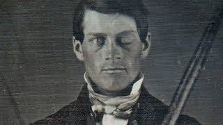 Why Scientists Are Still Fascinated By Phineas Gage [upl. by Kristoforo]