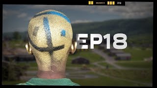 Bad Hair Day  EP18  Camp Woodward Season 9 [upl. by Aneelahs]